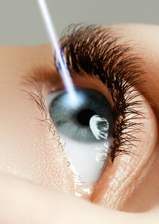 LASIK et PKR : les techniques de la chirurgie des yeux au laser